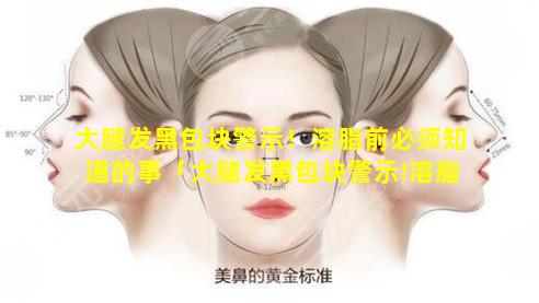 大腿发黑包块警示！溶脂前必须知道的事「大腿发黑包块警示!溶脂前必须知道的事 🌴 」